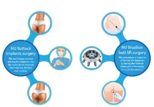 Butt Implant, Enlargement, Lift, Tightening Surgery Treatment In Navi Mumbai