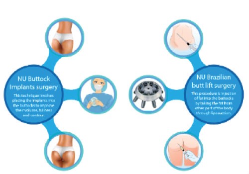 Butt Implant, Enlargement, Lift, Tightening Surgery Treatment In Navi Mumbai