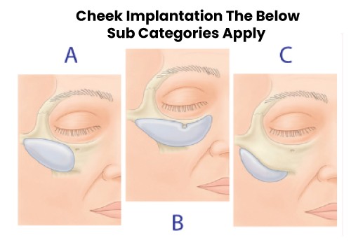 Chin Cheek Surgery Liposuction Treatment In Navi Mumbai