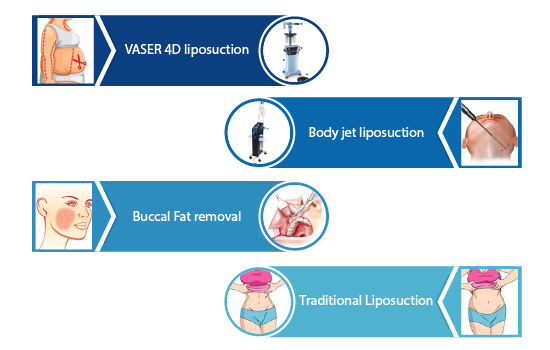 liposuction surgery