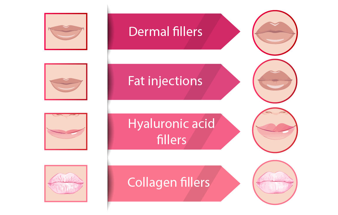 Breast surgery procedure
