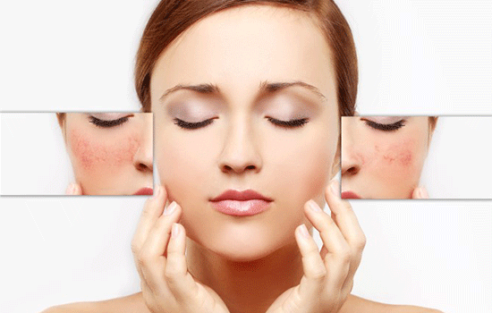 Acne Laser Treatment Clinic In Navi Mumbai