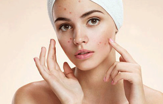 Acne Dark Spot Treatment In Navi Mumbai