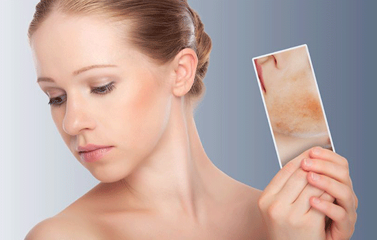 pigmentation birthmark removal