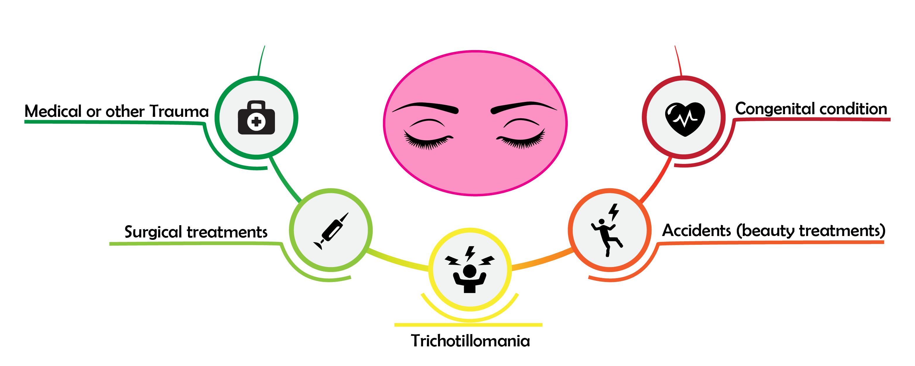 eye lash transplantation causes and effects