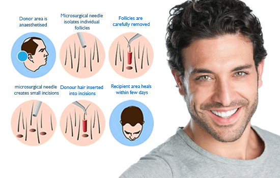 fue treatment clinic in navi mumbai