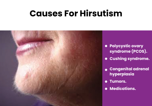 Hirsutism treatment in Navi Mumbai