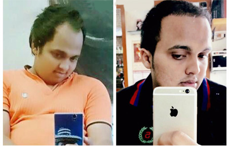 Female hair loss treatment in navi Mumbai