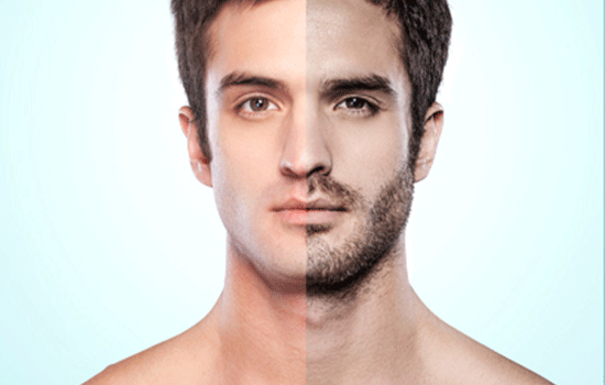 Beard Transplant Cost In Navi Mumbai