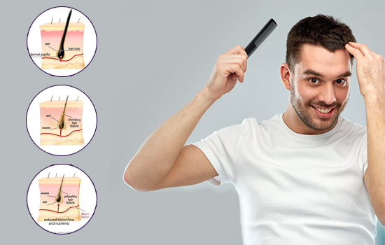 Direct Hair Transplant Cost In Navi Mumbai
