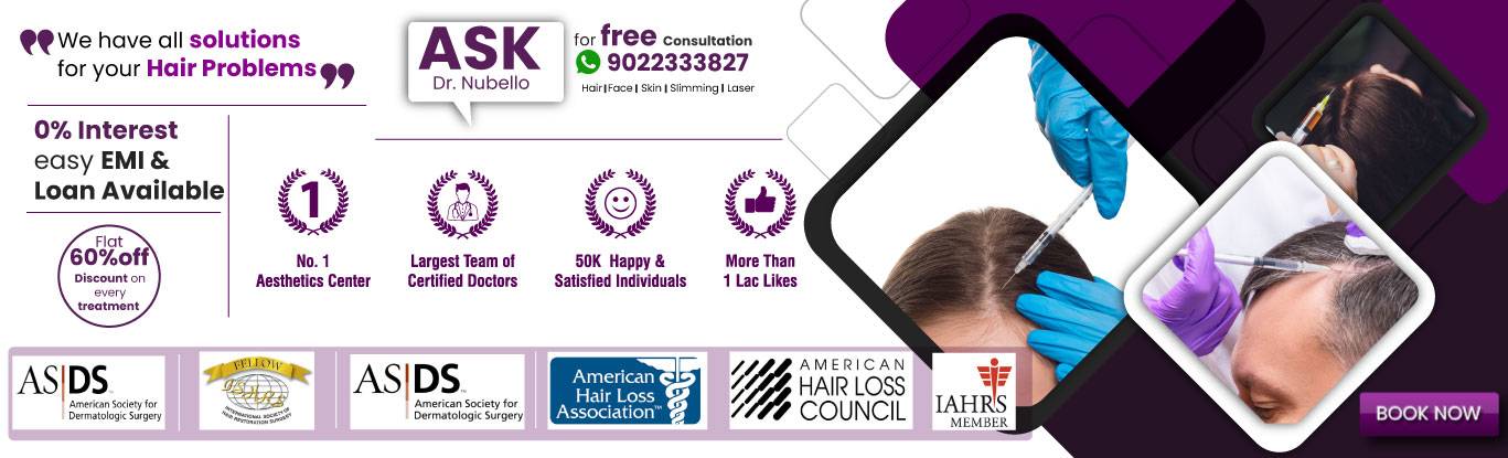 hair fall short hair treatment SHT