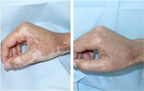 Female hair loss treatment in navi Mumbai