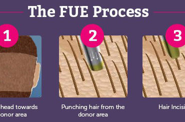 fue-process