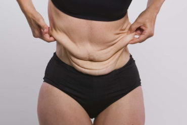 Woman holding skin of waist