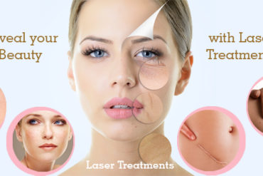 Laser-Treatments