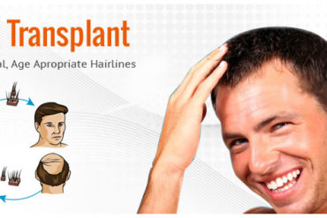 hair transplant treatment