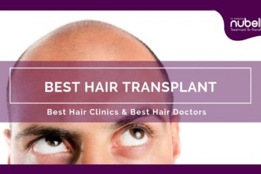 Best Hair Transplant in Andheri