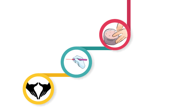 Procedur vaginal tighting 