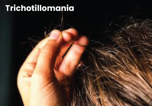 Trichotillomania Treatment in Mumbai