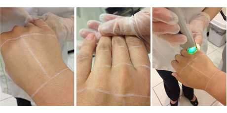 best hair transplantation clinic in mumbai