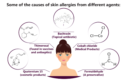 skin allergies from different agents