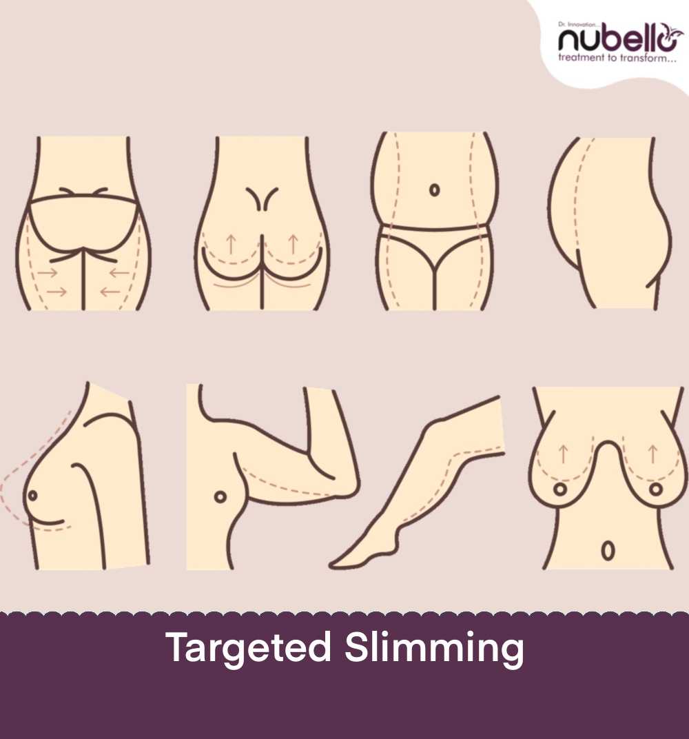 slimming-service